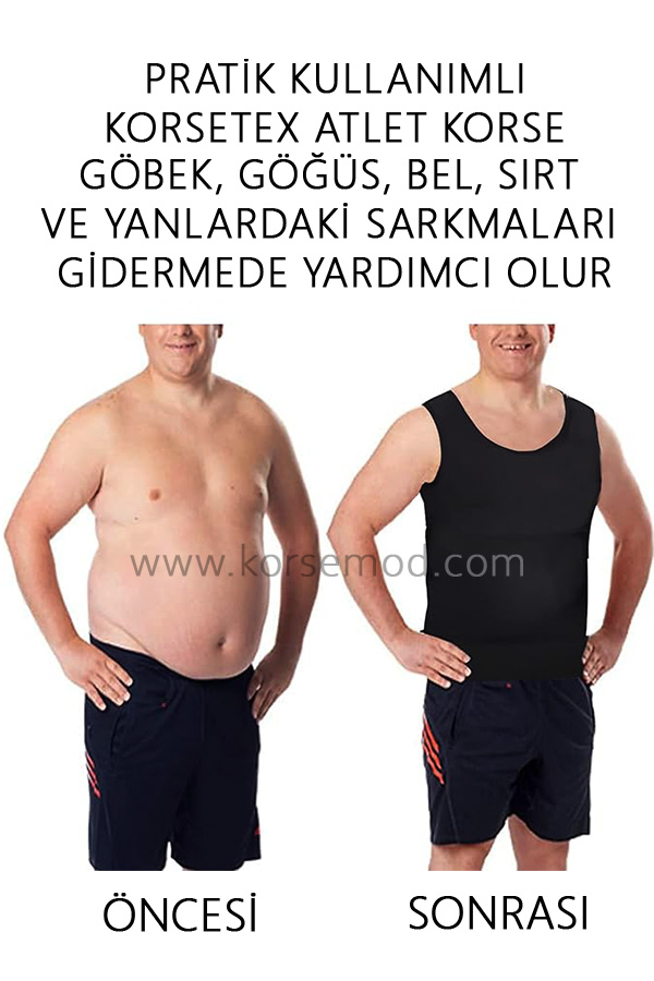 Sıkılaştırıcı Ve Toparlayıcı Premium Erkek Atlet Korse - Siyah